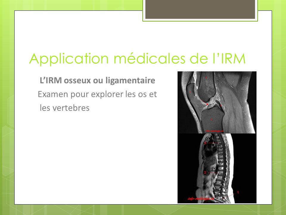 Application médicales de l’IRM L’IRM osseux ou ligamentaire Examen pour explorer les os et les vertebres