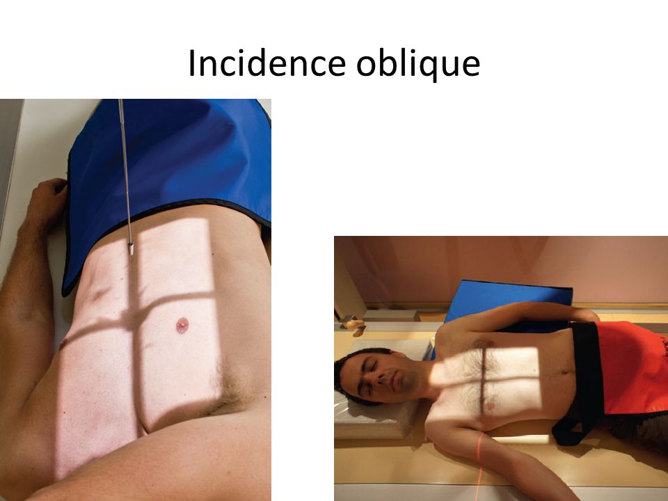Incidence oblique