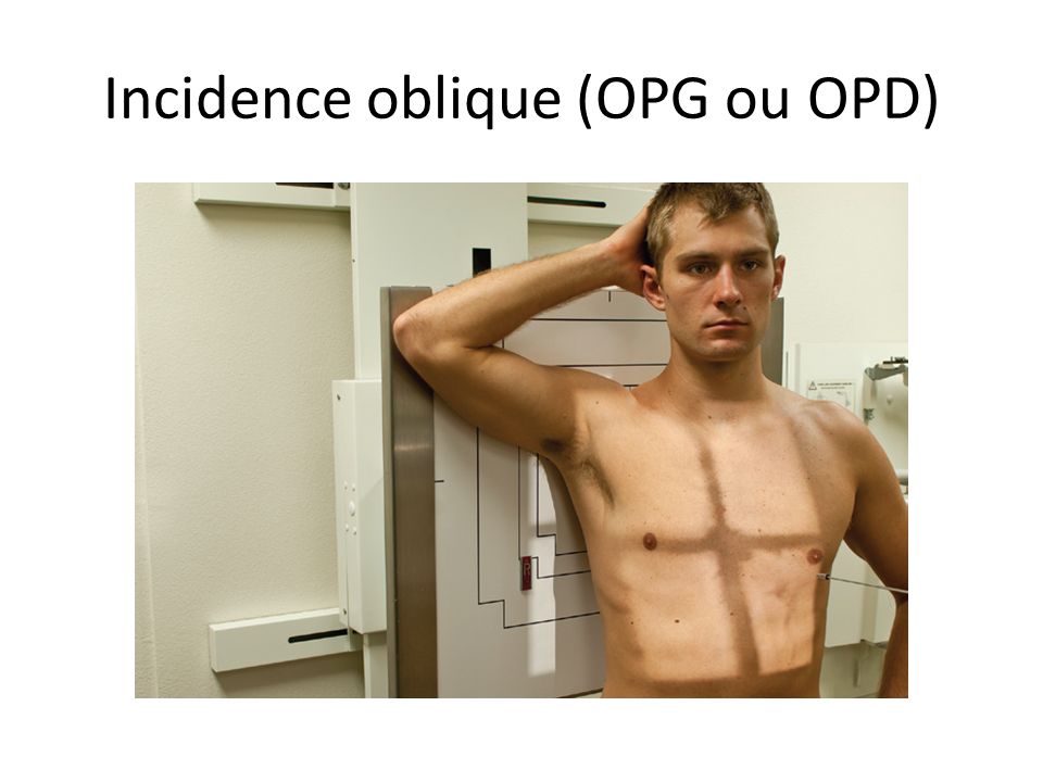Incidence oblique (OPG ou OPD)