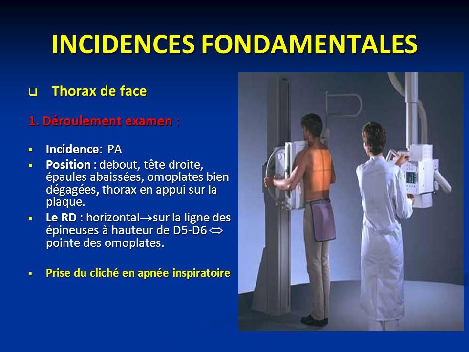 INCIDENCES FONDAMENTALES  Thorax de face 1.